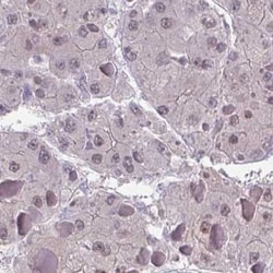 ZNF444 Antibody, Novus Biologicals:Antibodies:Primary Antibodies