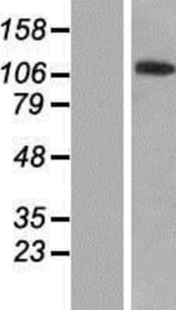Novus Biologicals&trade;&nbsp;ZNF445 Overexpression Lysate