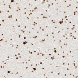 ZNF447 Antibody, Novus Biologicals 0.1mL; Unlabeled:Antibodies, Polyclonal
