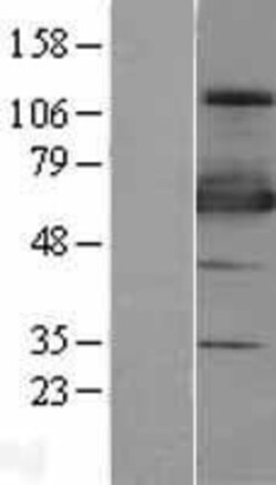 Novus Biologicals™ ZNF447 Overexpression Lysate