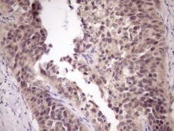 ZNF449 Antibody (OTI4C6), Novus Biologicals 0.1mL; Unlabeled:Antibodies,