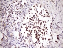 ZNF449 Antibody (OTI4C6), Novus Biologicals 0.1mL; Unlabeled:Antibodies,