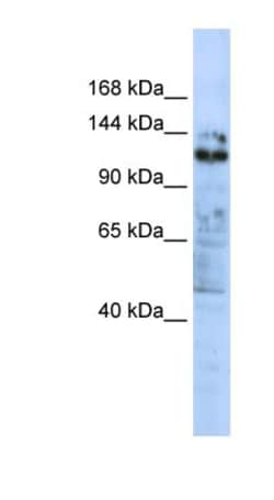 ZNF451 Antibody, Novus Biologicals 0.05mg; Unlabeled:Antibodies, Polyclonal