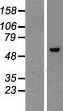 Novus Biologicals&trade;&nbsp;ZNF454 Overexpression Lysate