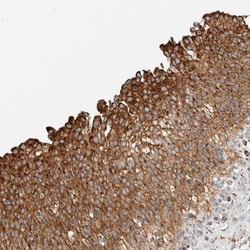 ZNF454 Antibody, Novus Biologicals 0.1mL; Unlabeled:Antibodies, Polyclonal