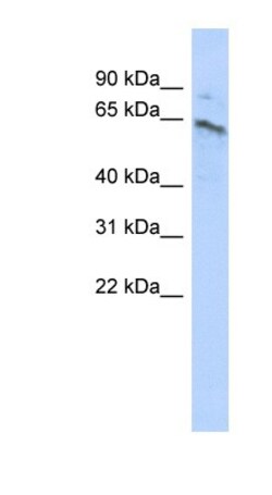 ZNF468 Antibody, Novus Biologicals 100&mu;L; Unlabeled:Antibodies, Polyclonal