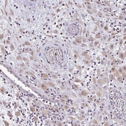 ZNF475 Antibody, Novus Biologicals:Antibodies:Primary Antibodies