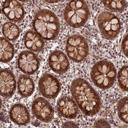 ZNF480 Antibody, Novus Biologicals 0.1mL; Unlabeled:Antibodies, Polyclonal