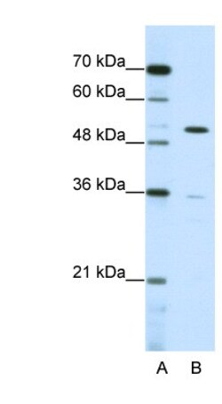ZNF485 Antibody, Novus Biologicals 20&mu;L; Unlabeled:Antibodies, Polyclonal