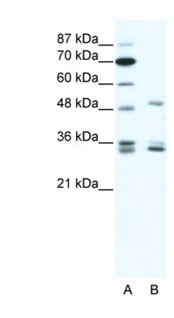 ZNF488 Antibody, Novus Biologicals 100 &mu;L | Buy Online | Novus Biologicals | Fisher Scientific