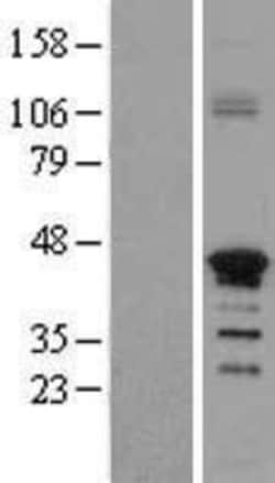 Novus Biologicals&trade;&nbsp;ZNF488 Overexpression Lysate
