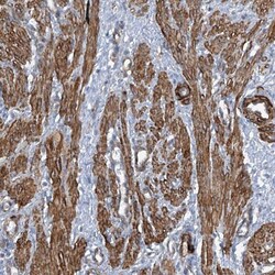 ZNF490 Antibody, Novus Biologicals 25 &mu;L; Unlabeled:Antibodies, Polyclonal