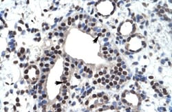 ZNF499 Antibody, Novus Biologicals 100 &mu;L | Buy Online | Novus Biologicals | Fisher Scientific