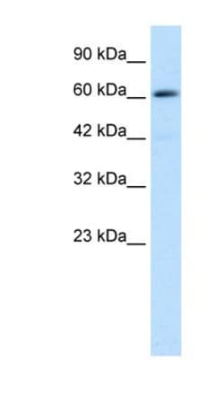 ZNF499 Antibody, Novus Biologicals 100 &mu;L | Buy Online | Novus Biologicals | Fisher Scientific