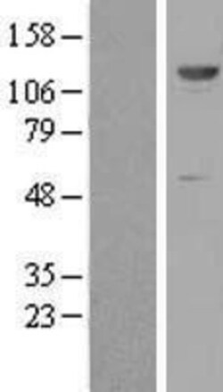 Novus Biologicals&trade;&nbsp;ZNF500 Overexpression Lysate