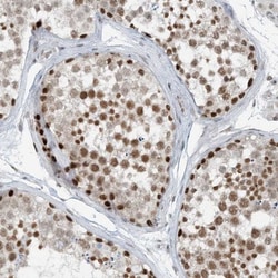 ZNF500 Antibody, Novus Biologicals:Antibodies:Primary Antibodies
