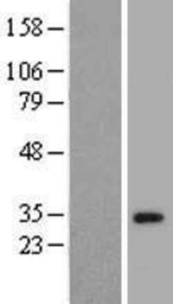 Novus Biologicals™ ZNF501 Overexpression Lysate