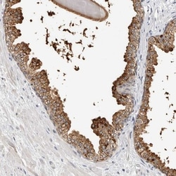 ZNF502 Antibody, Novus Biologicals:Antibodies:Primary Antibodies
