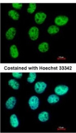 ZNF503 Antibody, Novus Biologicals 0.1mL; Unlabeled:Antibodies, Polyclonal