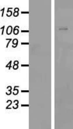 Novus Biologicals&trade;&nbsp;ZNF507 Overexpression Lysate