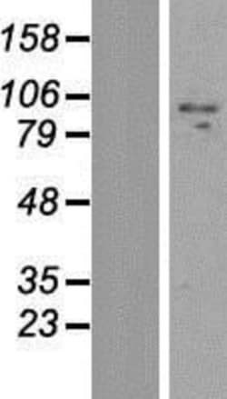 Novus Biologicals&trade;&nbsp;ZNF509 Overexpression Lysate