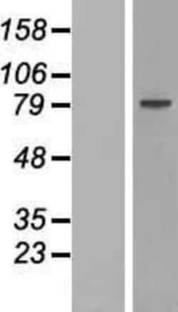 Novus Biologicals&trade;&nbsp;ZNF510 Overexpression Lysate