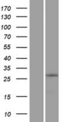 Novus Biologicals&trade;&nbsp;ZNF511 Overexpression Lysate