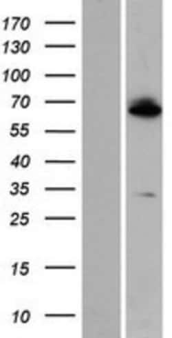 Novus Biologicals&trade;&nbsp;ZNF512 Overexpression Lysate