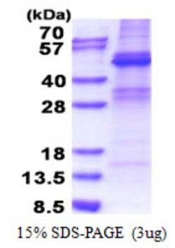 Novus Biologicals Recombinant Human ZNF514 His Protein 0.1 mg | Buy Online | Novus Biologicals&trade; | Fisher Scientific
