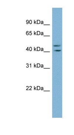 ZNF517 Antibody, Novus Biologicals 100&mu;L; Unlabeled:Antibodies, Polyclonal