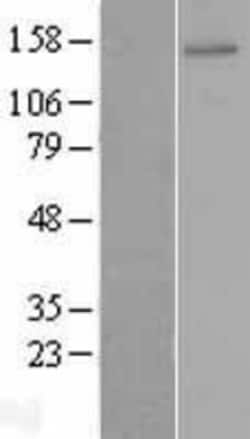 Novus Biologicals&trade;&nbsp;ZNF521 Overexpression Lysate