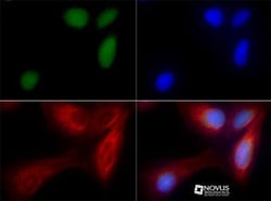 ZNF521 Antibody - BSA Free, Novus Biologicals 0.025mL; Unlabeled:Antibodies,