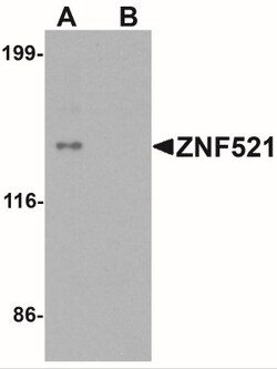 ZNF521 Antibody - BSA Free, Novus Biologicals:Antibodies:Primary Antibodies