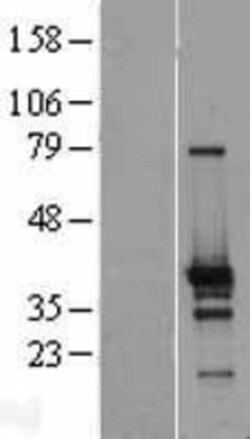 Novus Biologicals&trade;&nbsp;ZNF524 Overexpression Lysate