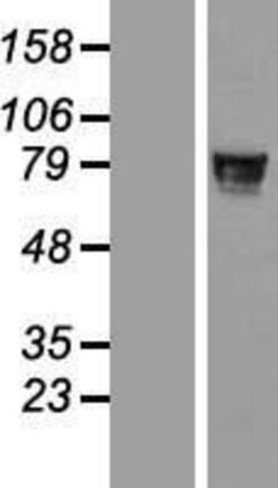 Novus Biologicals&trade;&nbsp;ZNF526 Overexpression Lysate
