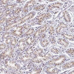 ZNF526 Antibody, Novus Biologicals:Antibodies:Primary Antibodies
