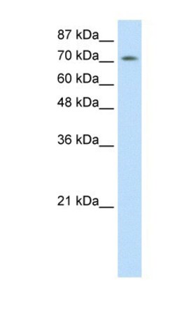 ZNF527 Antibody, Novus Biologicals 100&mu;L; Unlabeled:Antibodies, Polyclonal