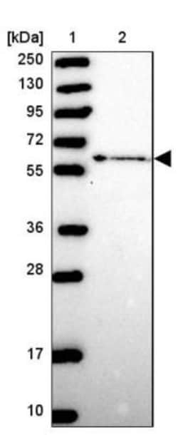 ZNF530 Antibody, Novus Biologicals 0.1mL; Unlabeled:Antibodies, Polyclonal