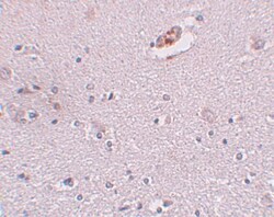 ZNF536 Antibody - BSA Free, Novus Biologicals 0.1mg; Unlabeled:Antibodies,