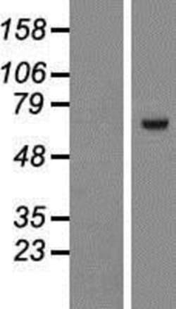Novus Biologicals&trade;&nbsp;ZNF543 Overexpression Lysate