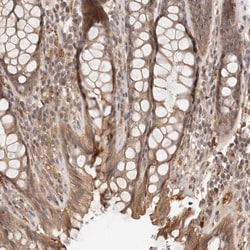 ZNF543 Antibody, Novus Biologicals 0.1mL; Unlabeled:Antibodies, Polyclonal