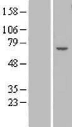 Novus Biologicals&trade;&nbsp;ZNF545 Overexpression Lysate