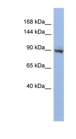 ZNF546 Antibody, Novus Biologicals 100&mu;L; Unlabeled:Antibodies, Polyclonal