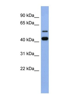 ZNF547 Antibody, Novus Biologicals 100&mu;L; Unlabeled:Antibodies, Polyclonal