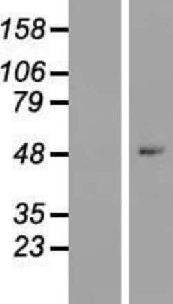 Novus Biologicals&trade;&nbsp;ZNF547 Overexpression Lysate