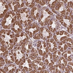 ZNF548 Antibody, Novus Biologicals 25 &mu;L, Unlabeled:Antibodies, Polyclonal