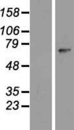 Novus Biologicals&trade;&nbsp;ZNF549 Overexpression Lysate
