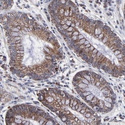 ZNF550 Antibody, Novus Biologicals 25 &mu;L; Unlabeled:Antibodies, Polyclonal