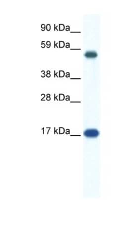 ZNF554 Antibody, Novus Biologicals™