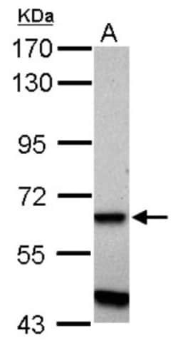 ZNF554 Antibody, Novus Biologicals 0.1mL; Unlabeled:Antibodies, Polyclonal